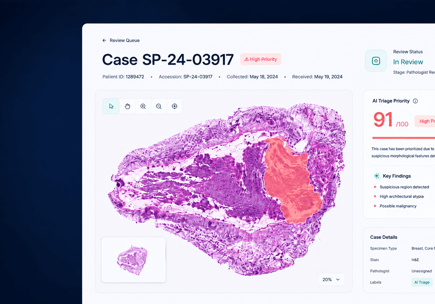 AI-Powered Pathology Slide Triage & Diagnostic Prioritization Platform
