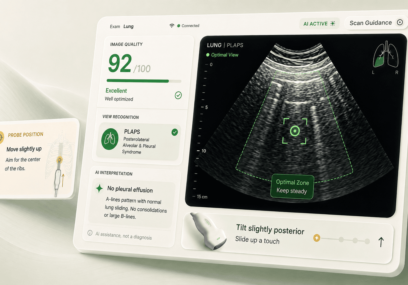 AI-Powered Point-of-Care Ultrasound Guidance & Interpretation Platform